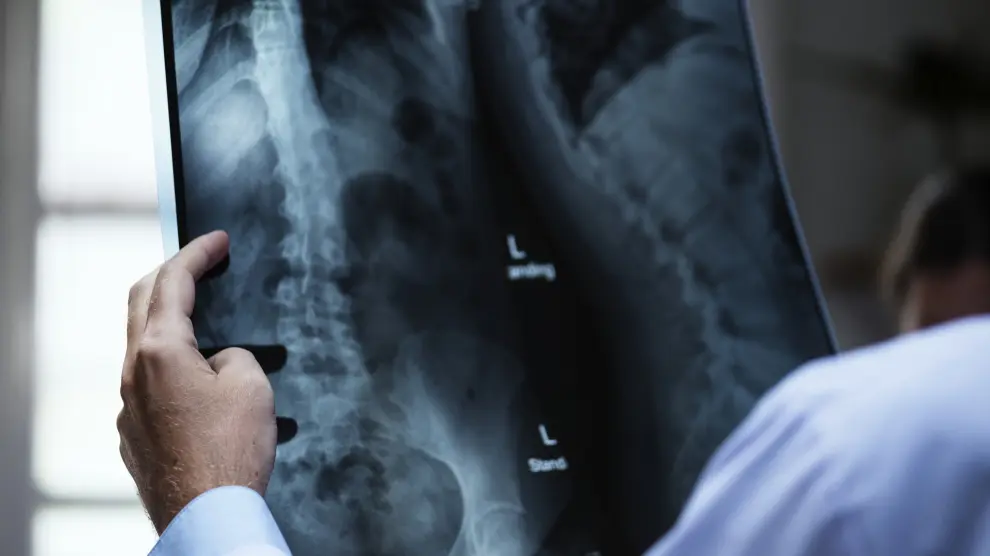 Pět vitamínů, které pomáhají předcházet osteoporóze